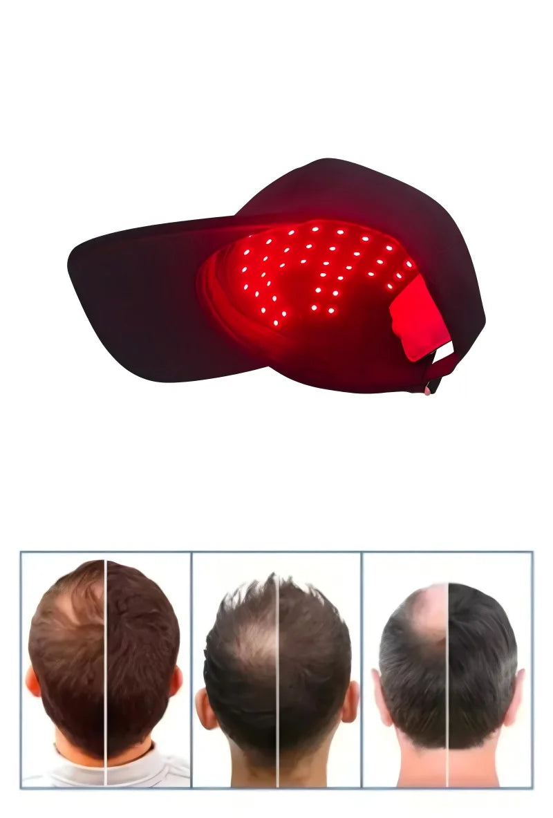 Professional Tech Laser Helmet for Dense Hair Nourishing 56 Electronic Diode Lamp Infrared Charging Violet Cap